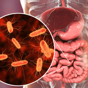 gut brain connection, healthy foods for bacteria 